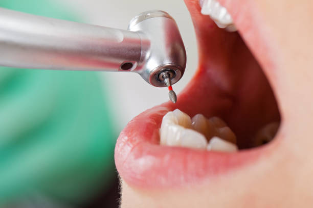 Best Emergency Dentist Near Me  in Mantua, VA